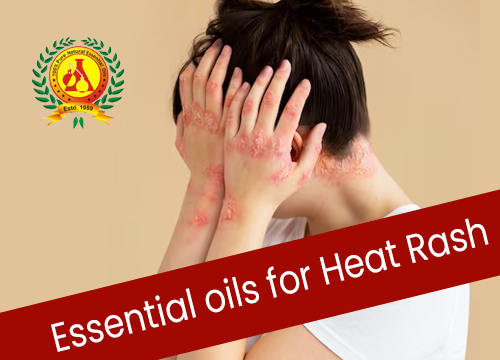 Essential oils for Heat Rash