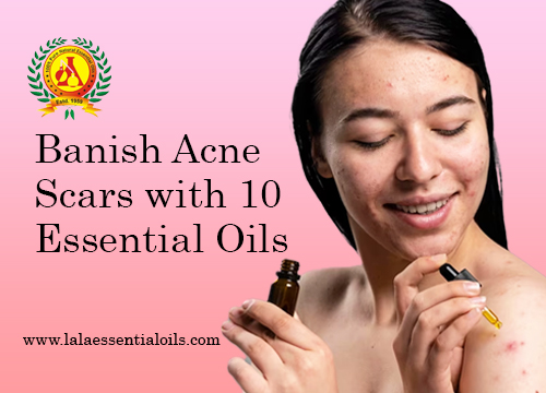Banish Acne Scars with 10 Essential Oils